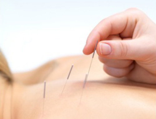 Acupuncture 101: A Few FAQ’s